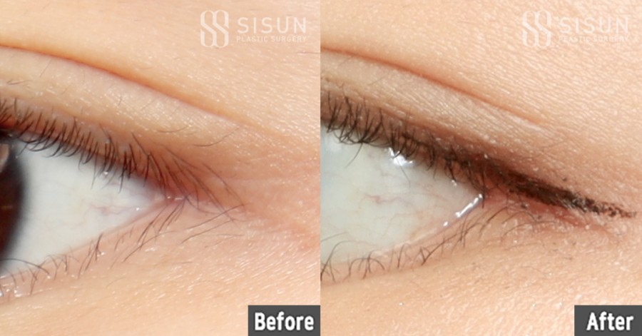 2079323fcee60fd65ccf5e698f99c834_1763542292_7916.jpg