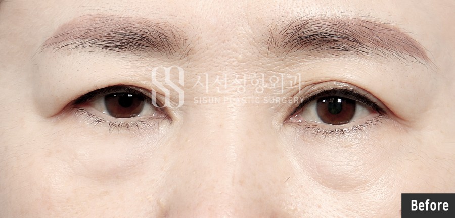 ce8eb25ab7846d4f62ee8ac72e77062b_1762849269_9541.jpg