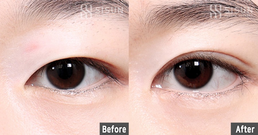 4e465189c1779d6afa71a55937842f84_1765440784_9968.jpg
