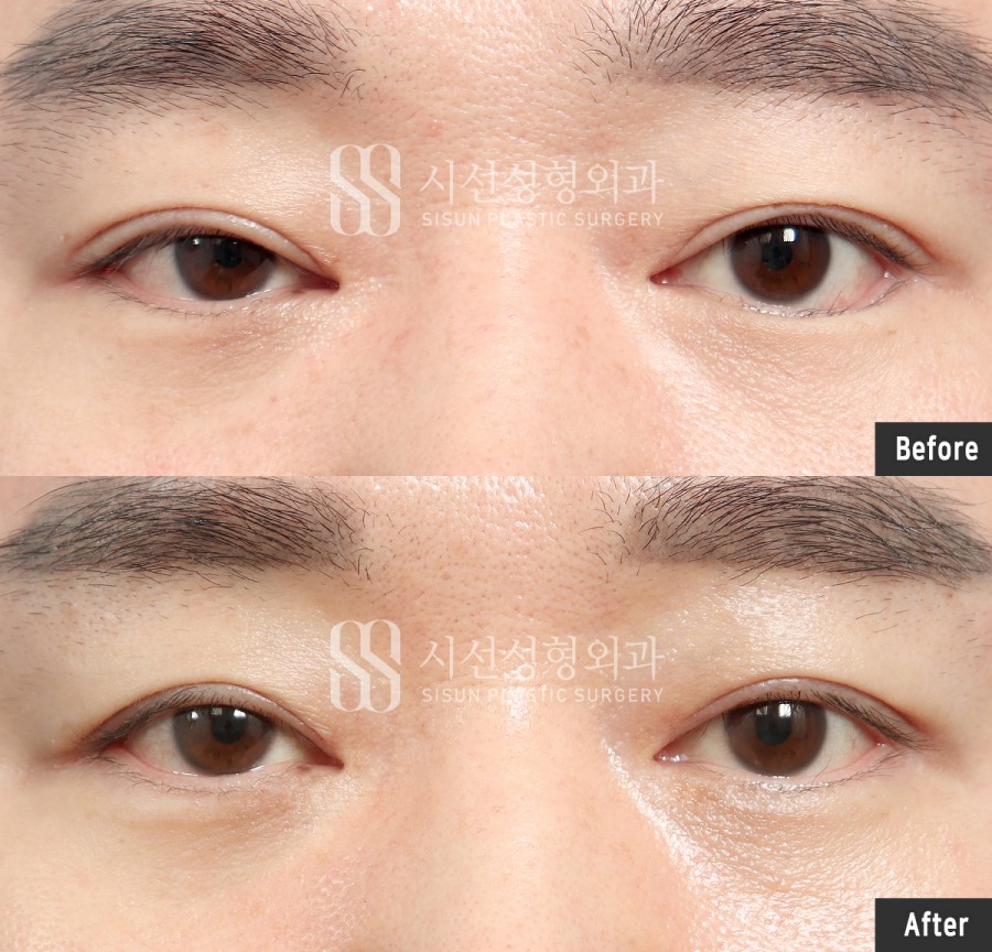 ef6dbd8ab7929b2cfcc0daead50a54b4_1764752770_9069.jpg
