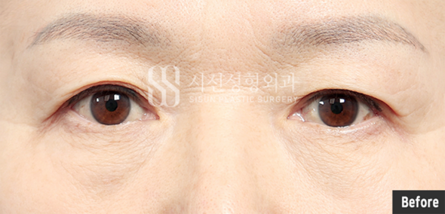 2e5f095860d5fb8f8e3a05a3fd1e06d3_1772092755_5035.png