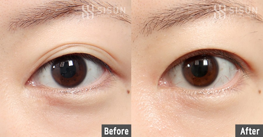 dd00d3e8c9135df7cce2bd6d505882a1_1770195089_8045.jpg