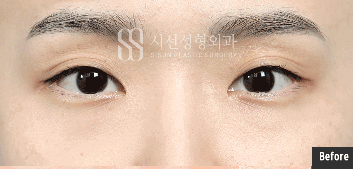 a3d7101f3aa60c689fecd71555d9796f_1773196490_7844.gif