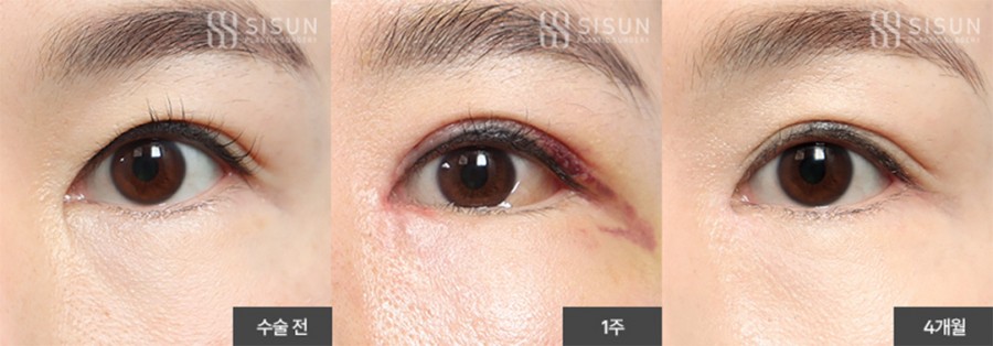 e1f06e61d151fa1d142337ff8ea83652_1773650301_7893.jpg