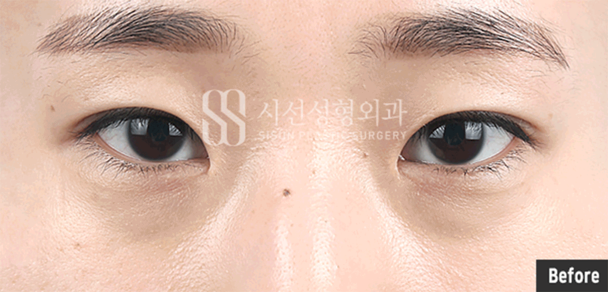 8dd87bfe4b604394afa888d08dd3c300_1775639571_571.gif