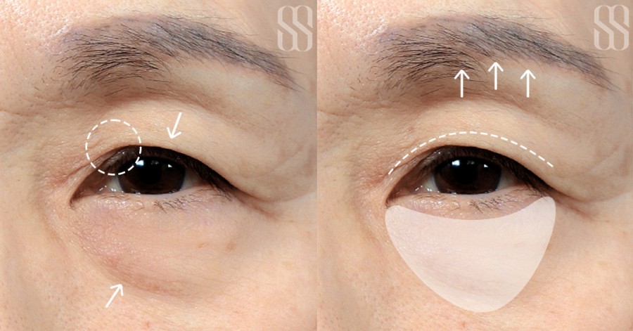 038f215b2b23ede87ab592cec50b0b56_1780907416_4773.jpg