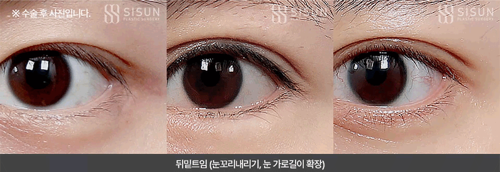 7ad9ff2e8b1dd097474e495c456530ea_1785373125_9486.gif