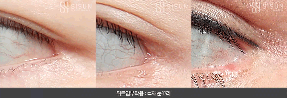 a3c1015c4bc39dd5f524fc8dff13c488_1785404429_3287.gif