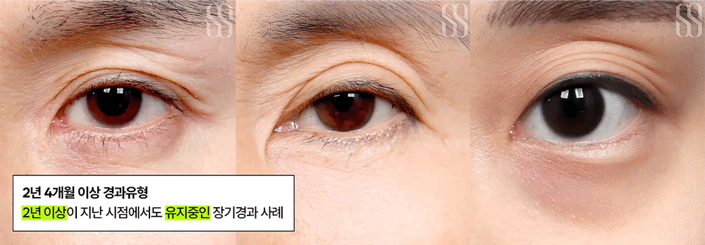 02acd92a5124d0a65d3af3f260c46c8c_1788916471_5406.gif