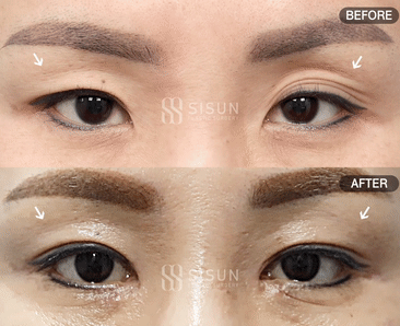 02acd92a5124d0a65d3af3f260c46c8c_1788916581_3862.gif