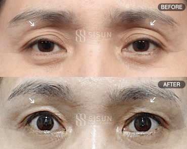 02acd92a5124d0a65d3af3f260c46c8c_1788916583_3626.gif