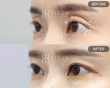 02acd92a5124d0a65d3af3f260c46c8c_1788916756_6947.gif