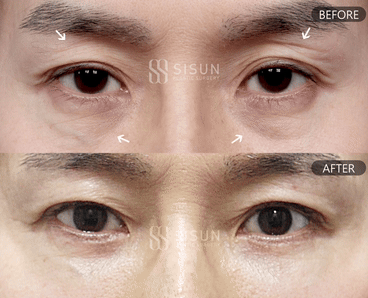 02acd92a5124d0a65d3af3f260c46c8c_1788916904_7831.gif