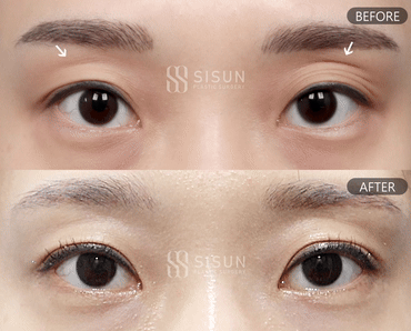 02acd92a5124d0a65d3af3f260c46c8c_1788916908_4482.gif