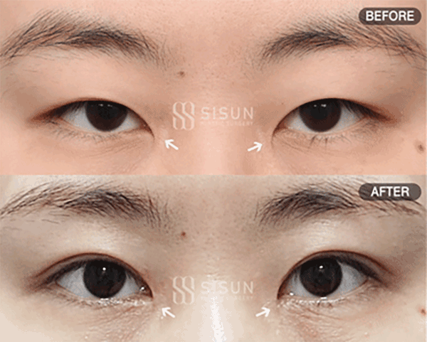 39c44f164f70d9e9d8354c6803b5dc55_1788947527_8614.gif