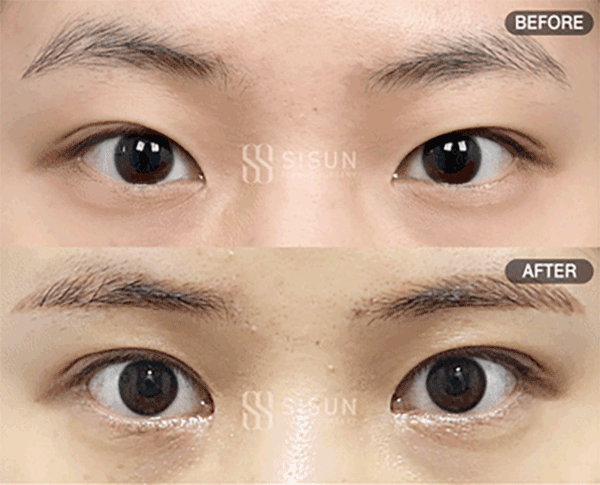 39c44f164f70d9e9d8354c6803b5dc55_1788947778_2151.gif
