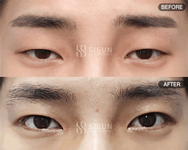 39c44f164f70d9e9d8354c6803b5dc55_1788947860_6079.gif