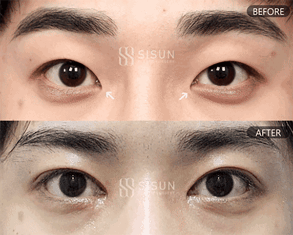 39c44f164f70d9e9d8354c6803b5dc55_1788947906_3743.gif