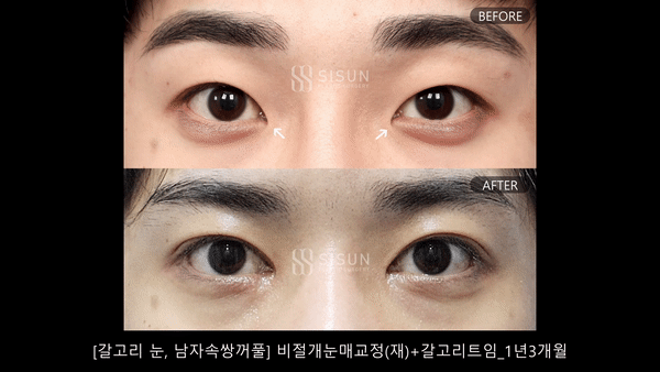 5de1fffa9fc0939c72a870230572e88f_1788758458_0749.gif