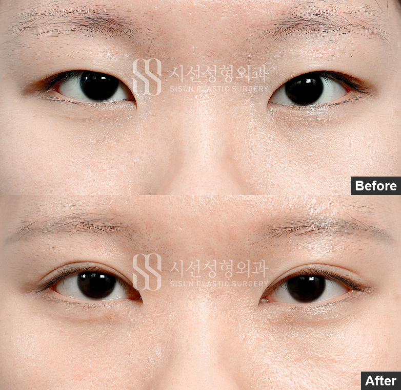 d3269a01981bea597ef593e1a8100257_1789008993_2034.jpg