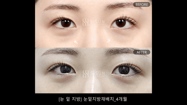 d3269a01981bea597ef593e1a8100257_1789027844_0784.gif