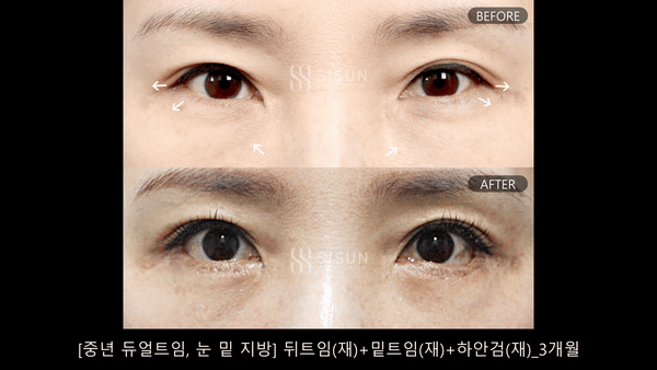 d89fa597cfbd2b336bfa2dd293656b42_1789984142_5078.gif