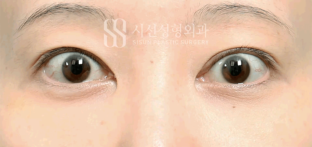 e08bde2cf09484aa54a7d9a5cb7e1eba_1790666917_8216.gif