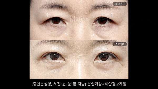 e99a69adb09a4b54a5dd2cd1614bceee_1788406209_582.gif