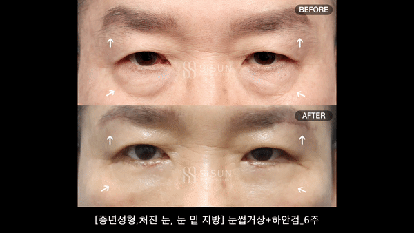 e99a69adb09a4b54a5dd2cd1614bceee_1788406216_0789.gif