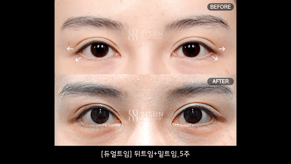 1ae7dde4ed39bd43b93680c9998903d8_1793235726_3615.gif 1ae7dde4ed39bd43b93680c9998903d8_1793235726_3615.gif