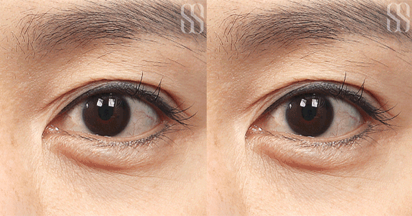 3d2cb81af8199af80c1df7b2614a9c1c_1793094667_3204.gif