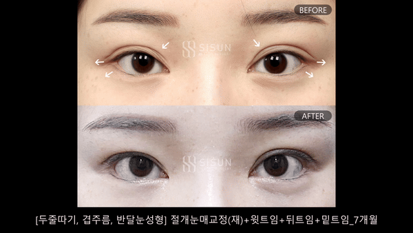 3d5db2df285bfcac2a88033811f472b9_1790846763_0763.gif