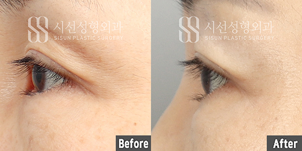 54753501bb598f489e6b63c8b659f436_1790934916_5015.jpg