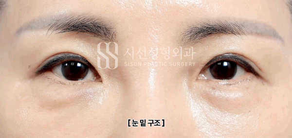 8bc4a9cf4039b9b2be08056dbaaeb62f_1793174021_0832.gif 8bc4a9cf4039b9b2be08056dbaaeb62f_1793174021_0832.gif