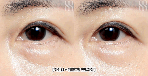 8bc4a9cf4039b9b2be08056dbaaeb62f_1793174065_6901.gif 8bc4a9cf4039b9b2be08056dbaaeb62f_1793174065_6901.gif