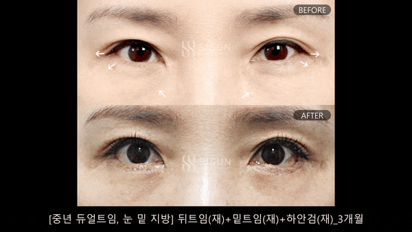 8bc4a9cf4039b9b2be08056dbaaeb62f_1793174242_0212.gif 8bc4a9cf4039b9b2be08056dbaaeb62f_1793174242_0212.gif