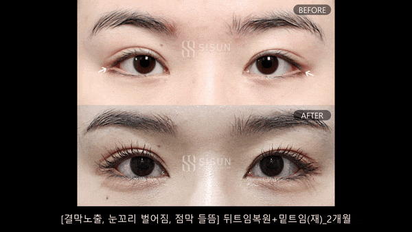 90d4ebdf3a003c9d207e938ee46027fe_1793347853_0848.gif