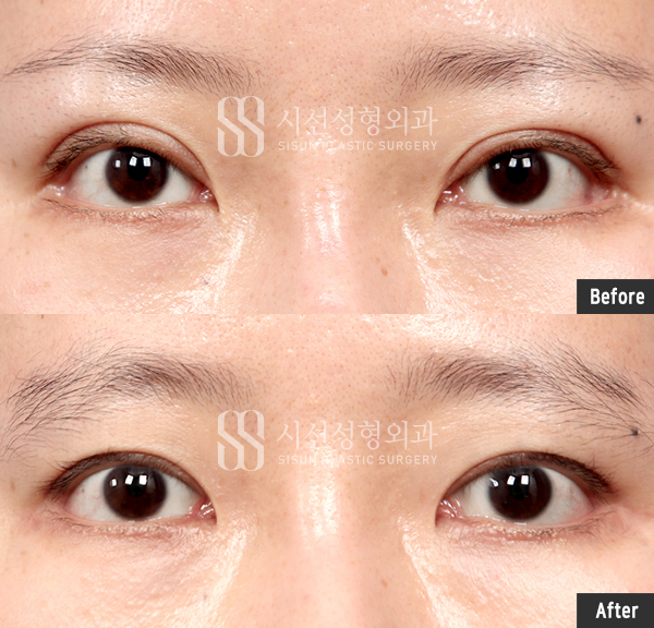 a8a4ccf92f44a43c25963ecb051a000d_1791366469_7639.jpg