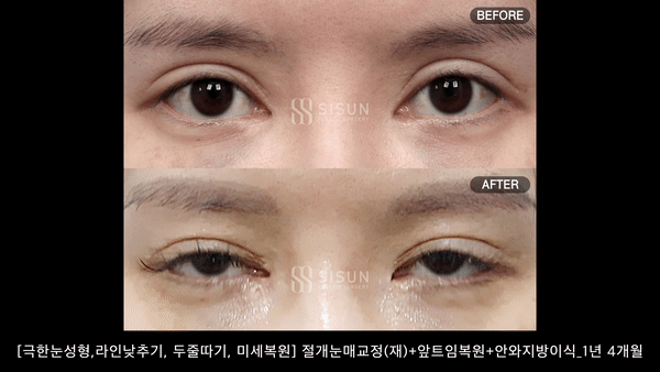 b1067a18cf8ed97c100720b611f9afe6_1790846252_7564.gif