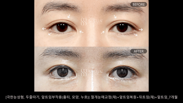 b1067a18cf8ed97c100720b611f9afe6_1790846326_7099.gif