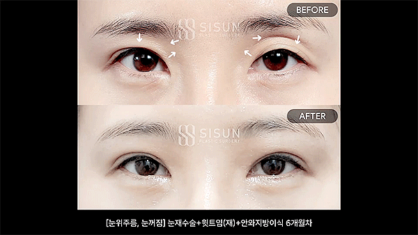 b40905d0cc99010a78448aed5f611452_1792401314_6161.gif