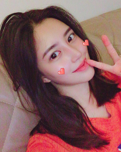 풀페이스 지방이식
