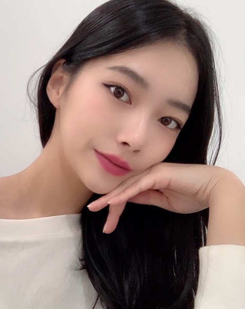 매몰 쌍꺼풀