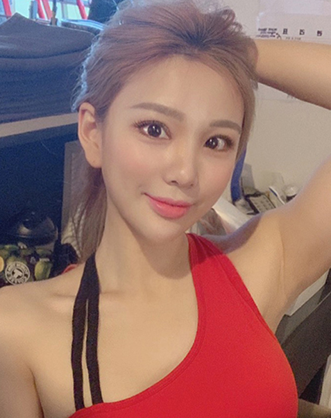 뒤트임+밑트임+코수술
