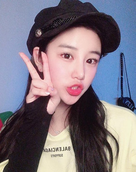 매몰 쌍꺼풀+앞트임+뒤밑트임