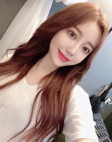 비절개 눈매교정(재수술)+뒤트임+밑트임+입술 필러