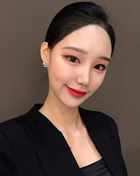 뒤트임+밑트임+이중턱 지방흡입+입꼬리 필러