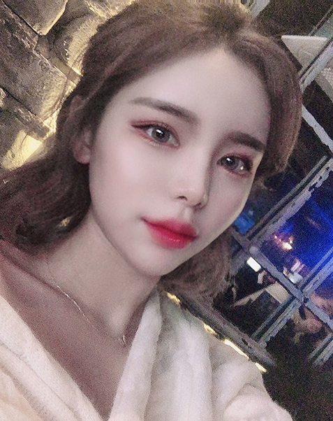 뒤트임+밑트임+턱 지방흡입