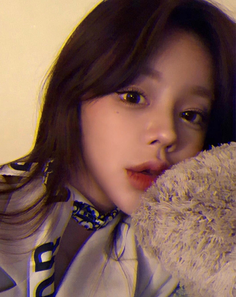 매몰 쌍꺼풀(재수술)+윗트임+뒤밑트임+풀페이스 지방이식