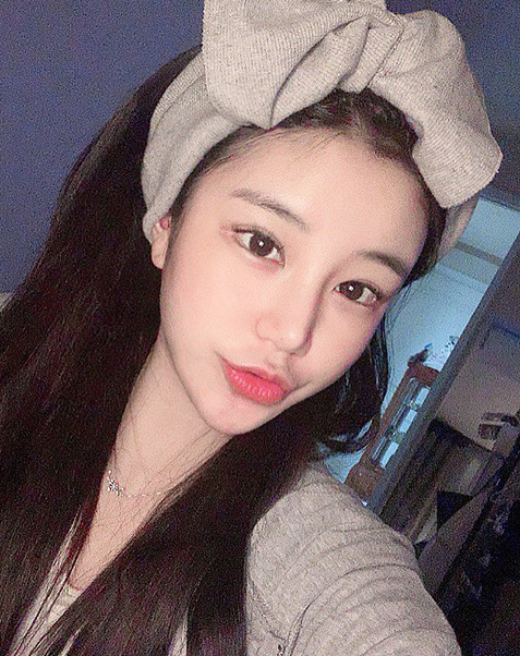 매몰 쌍꺼풀+앞트임+뒤트임+밑트임